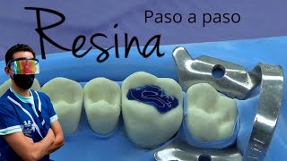 Como hacer una resina dental paso a paso [upl. by Luciana]