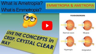 WHAT IS EMMETROPIA  WHAT IS AMETROPIA [upl. by Yesmar]