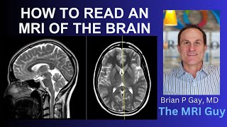 How to read an MRI of the brain  First Look MRI [upl. by Name]