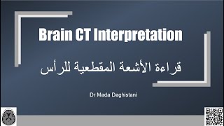 Brain CT interpretation قراءة الاشعة المقطعية للرأس [upl. by Alidus]