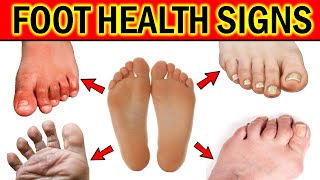 What Your Feet Can Tell You About Your Health [upl. by Daly]