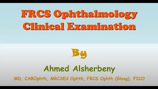 Clinical Ocular Examination  Part 2 Pupil Examination Part 2 amp Confrontation Test [upl. by Hafler]