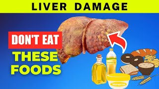 Liver Damage Alert Avoid These 7 Toxic Eats [upl. by Inilahs120]