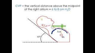 Jugular Venous Pressure [upl. by Noved]