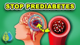 TOP 11 Prediabetes Symptoms and Treatment  How to STOP Prediabetes NOW [upl. by Tierell195]