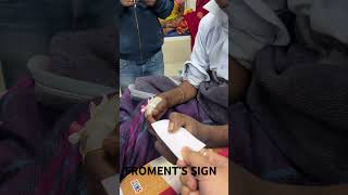 Froment’s Sign Book Test for Ulnar Nerve Palsy [upl. by Oidale]