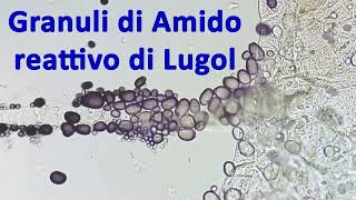 Amido e reattivo di Lugol  reazione dei granuli osservata al microscopio 🔬 [upl. by Leo517]