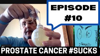 Episode 10 What do you do when aggressive prostate cancer hits fast [upl. by Ateerys]