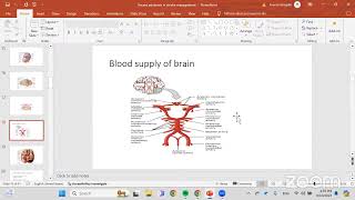 “Brain Stroke  Recent Developments” [upl. by Rotceh]