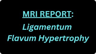 What is Ligamentum Flavum Hypertrophy [upl. by Klute]