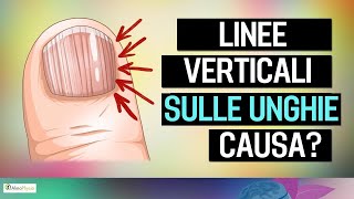 Le vere cause delle linee verticali sulle unghie [upl. by Idok]