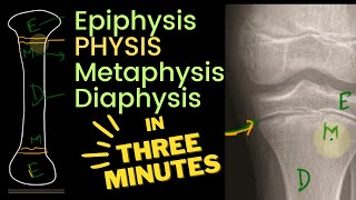 Physis Epiphysis Metaphysis and Diaphysis 🦴  in 3 MINUTES [upl. by Biernat]