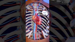 Pacemaker pacemaker heart cardiology heartattack shorts medical nursing viralvideo stunt [upl. by Nnairrehs28]