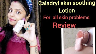 caladryl lotion reviewany skin allergiesone solutionin hindi [upl. by Felecia]