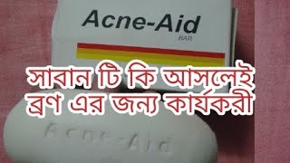 Acne aid soap bar review [upl. by Nnomae824]