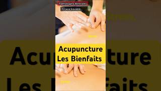 Acupuncture Bienfaits et indications acupuncture acupoints acupoint médecinealternative ytb [upl. by Alien492]