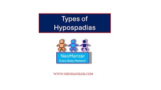 Hypospadias Types Newborn Infants [upl. by Eimak]