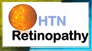 hypertensive retinopathy شرح [upl. by Lilahk125]