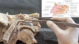 Dissection of lateral wall of nasal cavity  Anatomy of meatus and concha  structures within meatus [upl. by Haela]