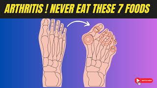 Arthritis Warning NEVER Eat These 7 Foods😱  Arthritis Causing Foods [upl. by Sueahccaz]