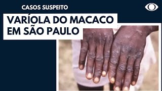 Cidade de SP investiga caso suspeito de varíola dos macacos [upl. by Nesaj]