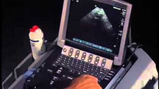 How To Transabdominal View of the Female Pelvis with Ultrasound [upl. by Eintroc]