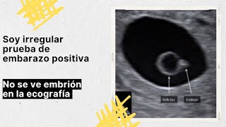 MI PERIODO ES BASTANTE IRREGULAR PRUEBA DE EMBARAZO POSITIVA ECOGRAFIA VAGINAL NO SE OBSERVA EMBRIÓN [upl. by Andriette]