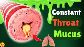 6 Real Causes of Phlegm amp Mucus in Your Throat Stop Constant Throat Clearing  VisitJoy [upl. by Mohammad307]