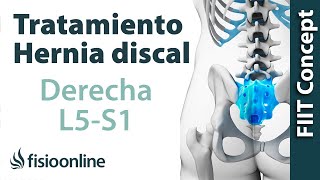 Tratamiento de la hernia discal L5 y S1 derecha o quinta lumbar y sacro [upl. by Leviram]