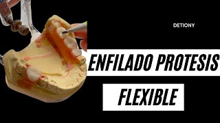 Enfilado en protesis Flexibles Dentales Paso a Paso [upl. by Roana]