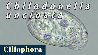 Chilodonella uncinata Ciliophora  Ciliate №2 [upl. by Monroy]