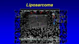 Ultrasonography of Superficial Soft Tissue Masses [upl. by Celesta]