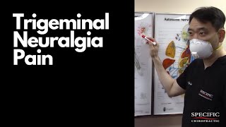 Trigeminal Neuralgia Pain Relief by Dr Suhs Facial Pain Treatment at Specific Chiropractic NYC [upl. by Stacie108]