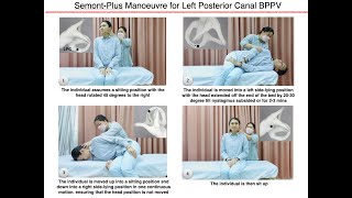 SemontPlus Manoeuvre for Left Posterior Canal BPPV [upl. by Morten743]