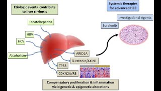 Types of Investigations for Hepatocellular Carcinoma [upl. by Adhern]