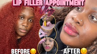 LIP FILLER VLOG ON BLACK GIRLWOMAN 🫦💉  RAW amp UNCUT FULL EXPERIENCE [upl. by Izzy]