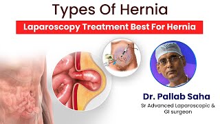 Hernia Symptoms and Treatment  Best hernia treatment in Kolkata laparoscopicsurgery hernia [upl. by Llevad916]