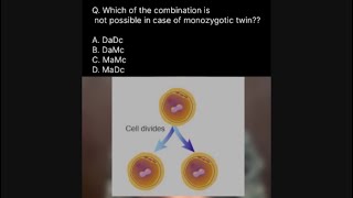 Types of monozygotic twins [upl. by Natanoy]