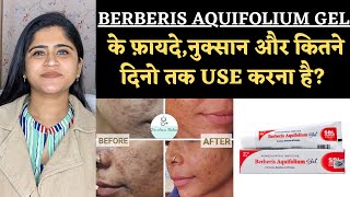 Berberis Aquifolium Gel Benefits amp Side effects ॥ कितने दिन में Results मिलते है [upl. by Bernardi]