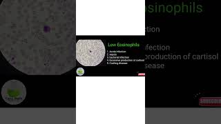 low eosinophilia eosnophl cbc biology education science tanutalks [upl. by Asyla853]