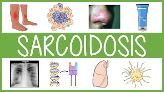 Sarcoidosis in 3 Minutes [upl. by Yror40]