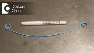 What is a Ureteral Stent How is a Stent placed amp removed Dr Santosh Bethur [upl. by Eladnyl]