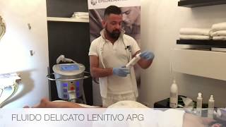 EPILAZIONE LASER DIODO 808 nm COME FUNZIONA  2016 VIDEO TECNICO  VIDEO TRATTAMENTO [upl. by Inahet867]