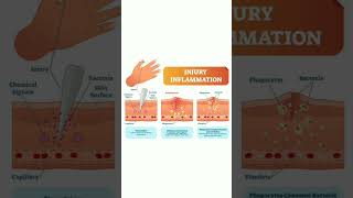 Injury inflammation ytshorts youtubeshorts medicaleducation [upl. by Garek]