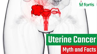 Uterine Cancer  Myth and Facts  uterine cancer symptoms  endometrial  endometrial symptoms  MUL [upl. by Gatian]