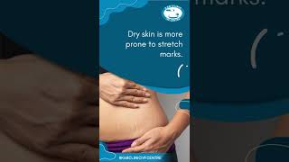 Tips to prevent Stretch Marks [upl. by Rodney663]