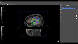 BrainMagix 20 The Brains Wiring Part 2 [upl. by Krantz]