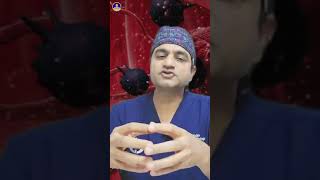 What is Radio Ablation Frequency RFA cancertreatment doctor ytshorts [upl. by Editha]