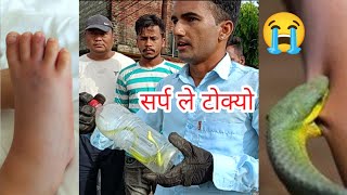 🐍 😭 पढन हिँडे की बालिका लाई सर्प ले दुई पटक टोक्यो। भयो ठूलो घटना Green pit viper bite [upl. by Enerod798]