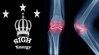 Subchondral Sclerosis Healing and Regeneration EXTREMELY POWERFULEnergetically Programmed [upl. by Larochelle]